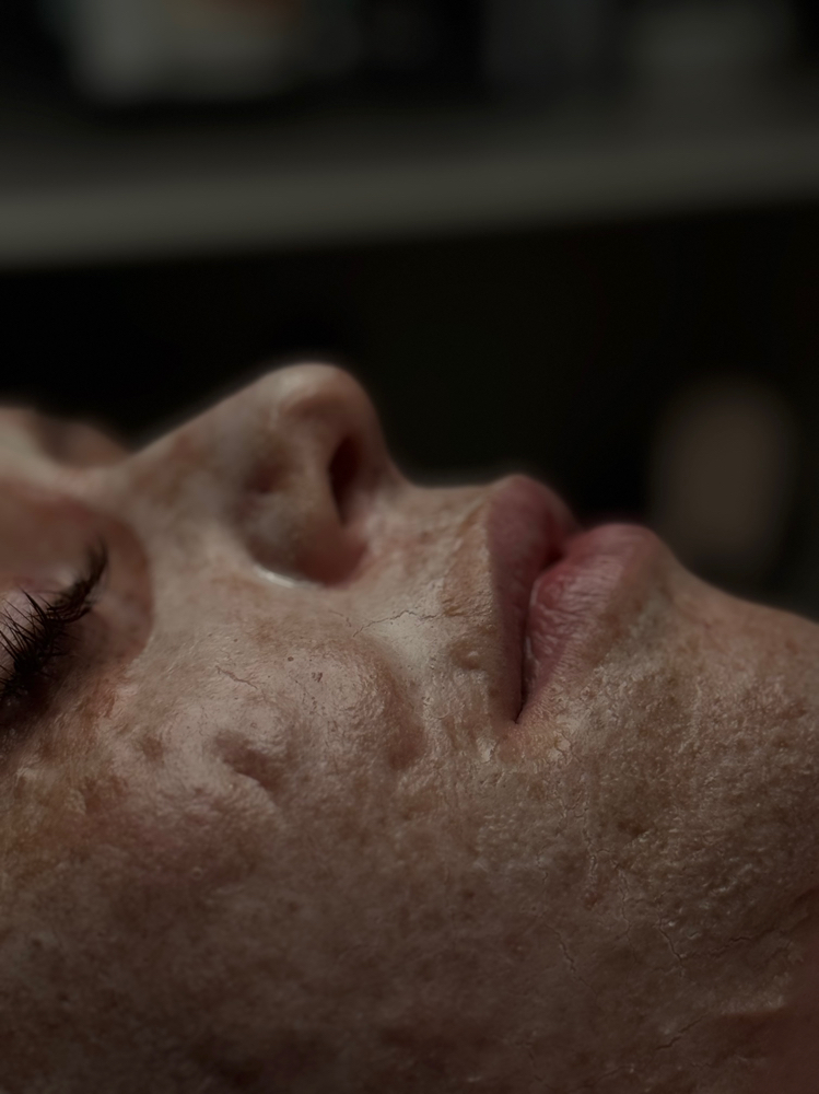 Tightening Protein Facial