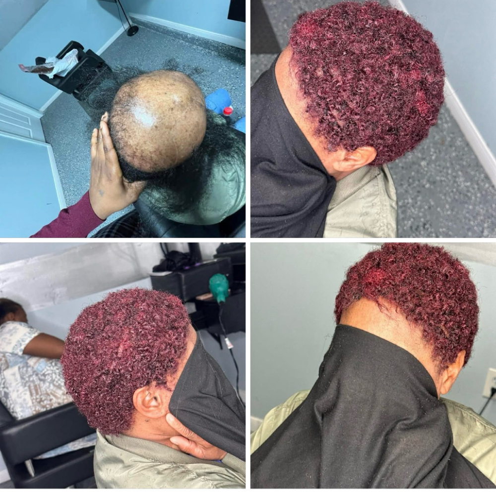 Alopecia /hairloss Low Cut at Tobs braiding salon llc in Houston, TX