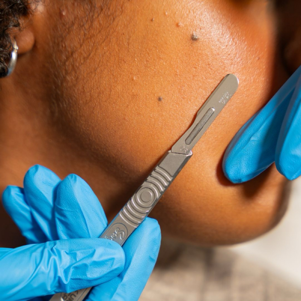 Dermaplaning at Faith Over Fear Esthetics in Lexington, KY