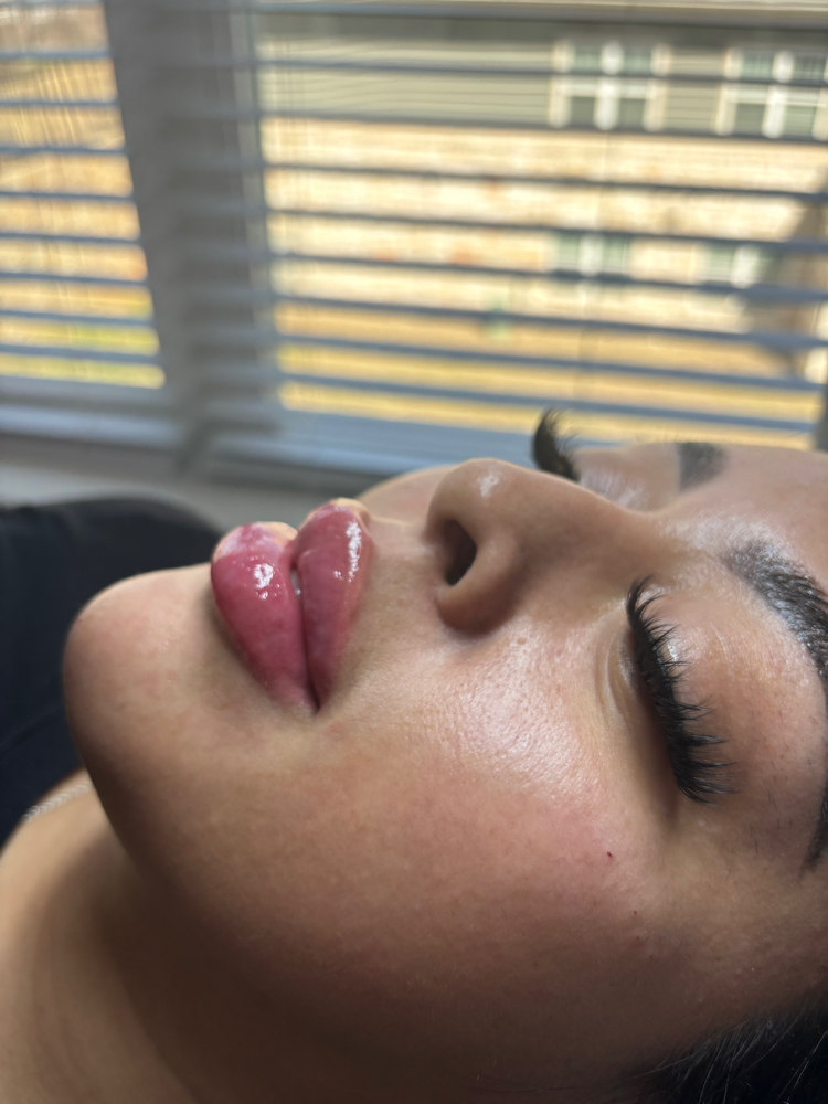 Cheeks + Chin