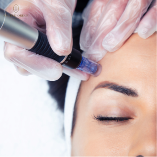 Microneedling Treatments at Sacred Order Beauty in Key Largo, FL