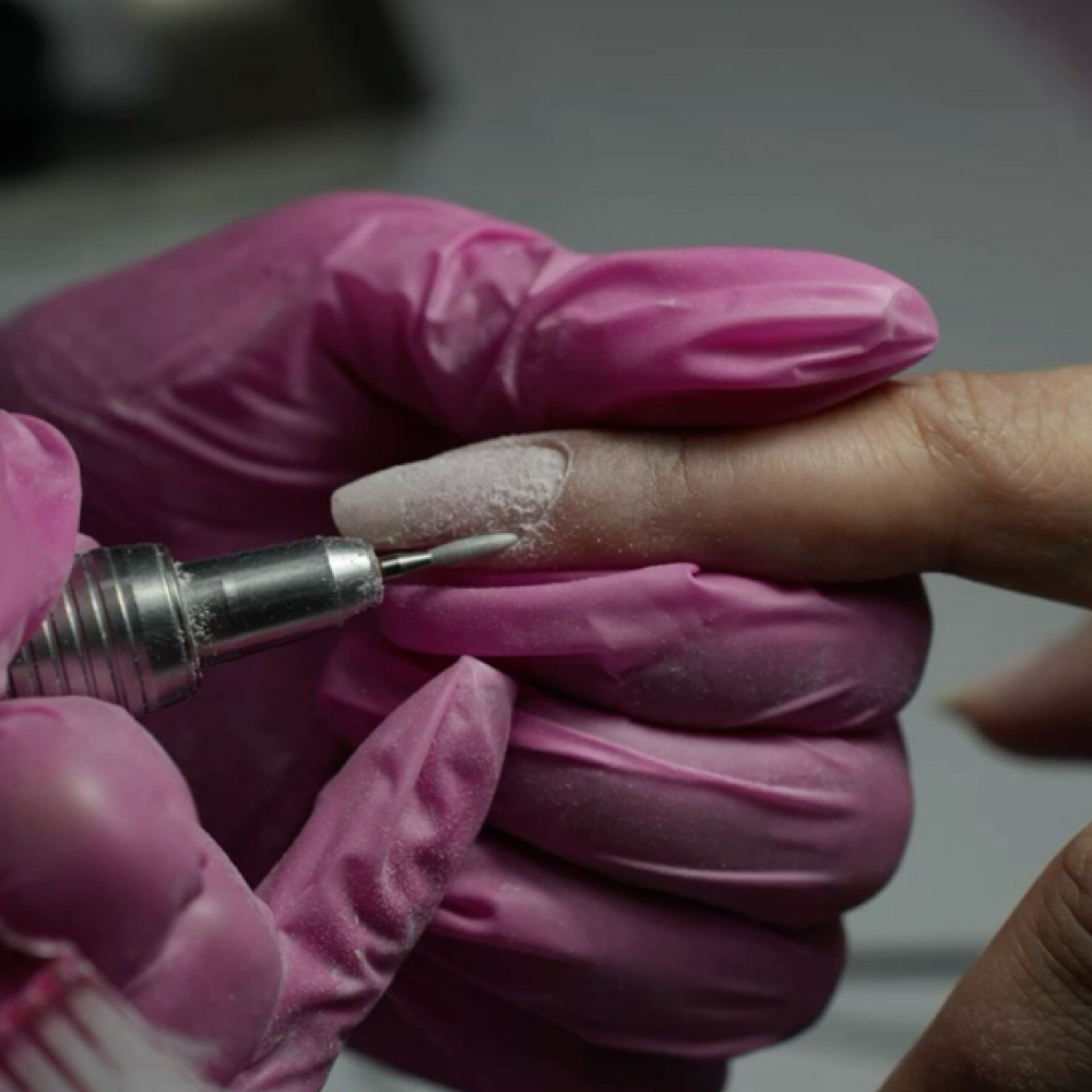 Nail Removals at Cloud9 Esthetics in St  Louis, MO