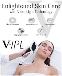 Complimentary IPL Consultation