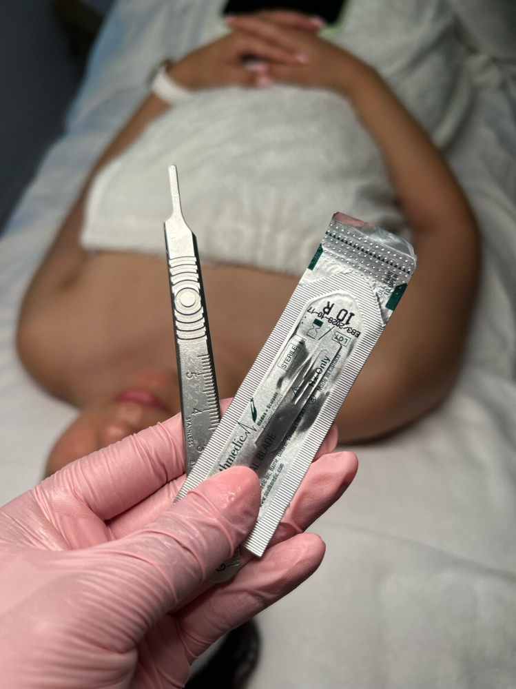 Add On: Dermaplane