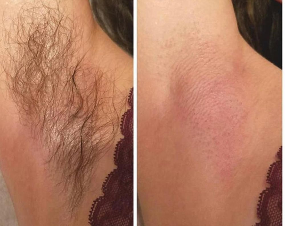 Under Arm Wax