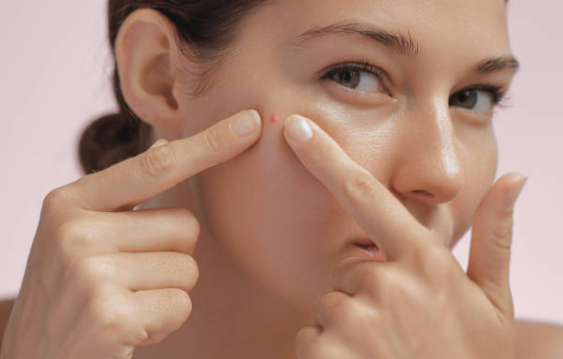 Acne Clean-Clear Customized Facial