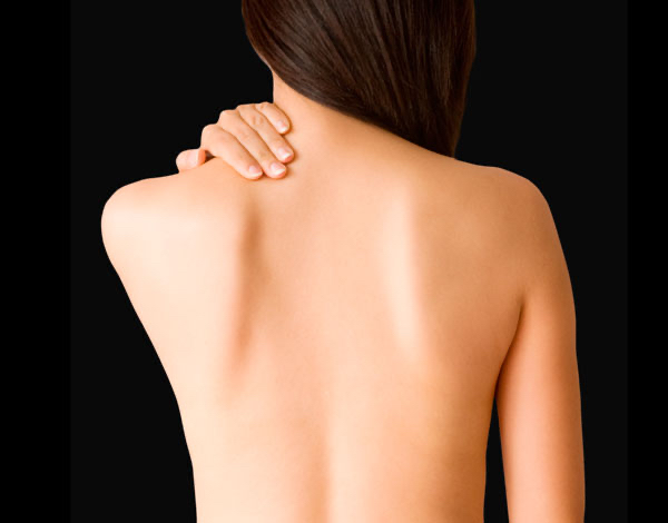 Chemical Peel (Back)