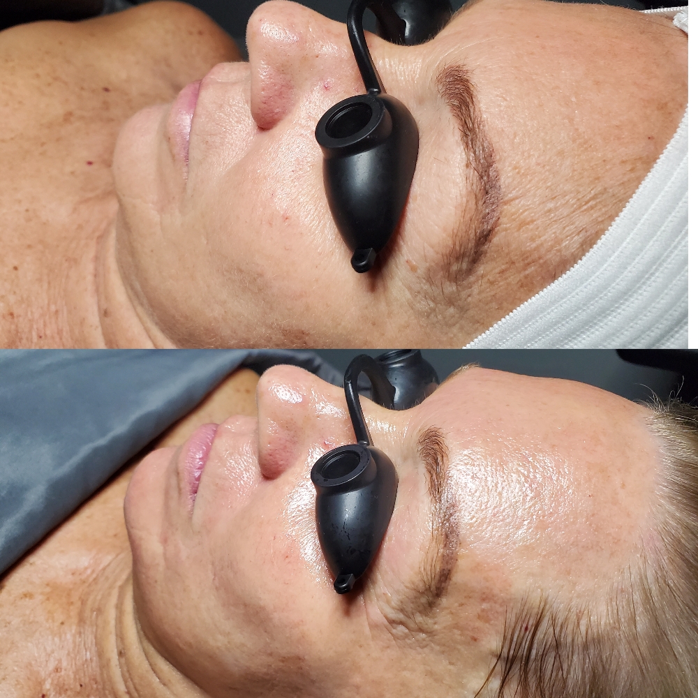 New Client Anti-Aging Facial