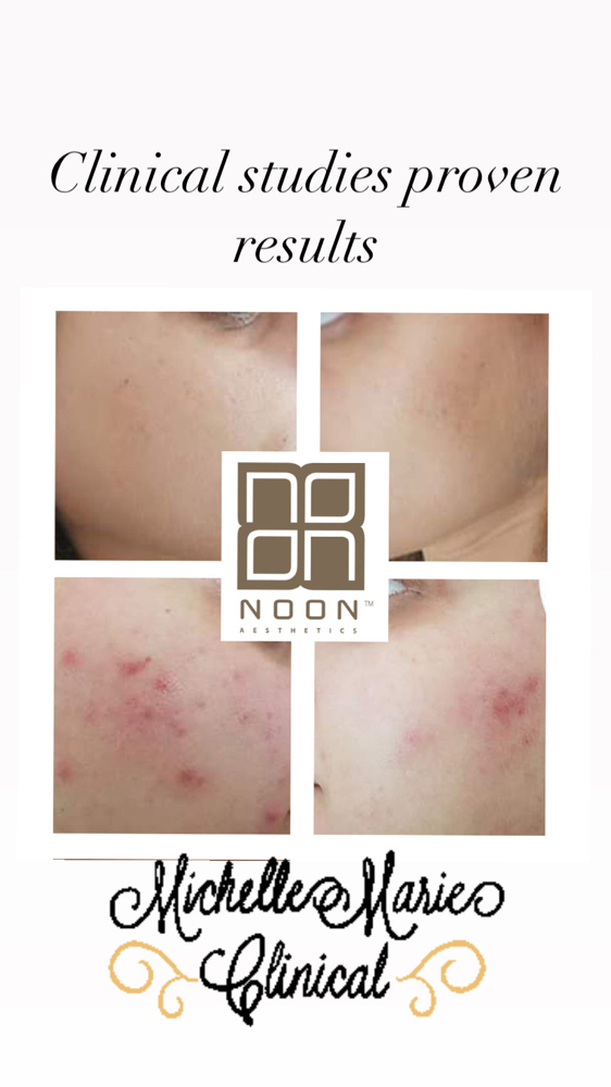 MMC Corrective Skincare Treatment