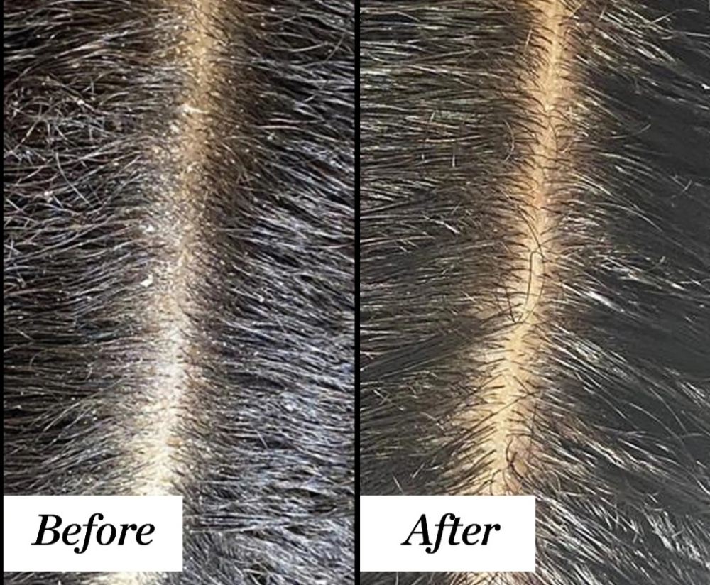 Scalp.Detox.Rebalance(Scalp Facial)