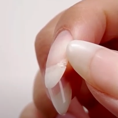 Nail Repair