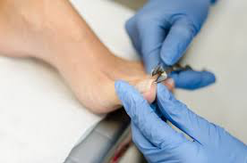 Toenail Clipping