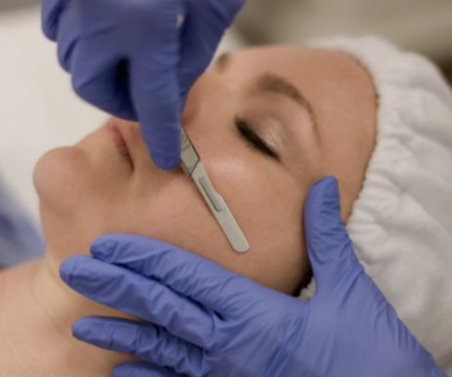 Dermaplane Facial