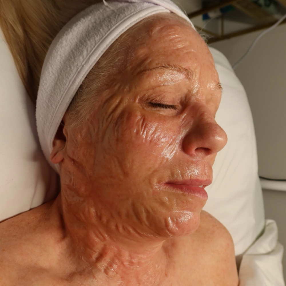 Foundation Of Youth Facial at Sweet Face Beauty in Canton, OH