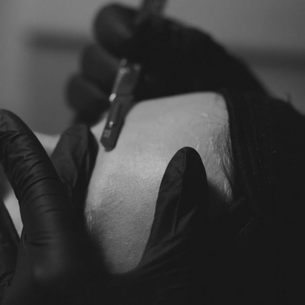 Signature Dermaplane Treatment at Esthetics by Haley in Perrysburg, OH