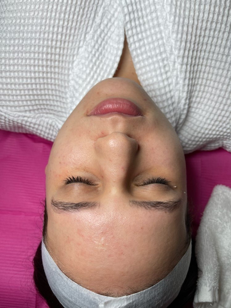 Deep Cleansing Facial