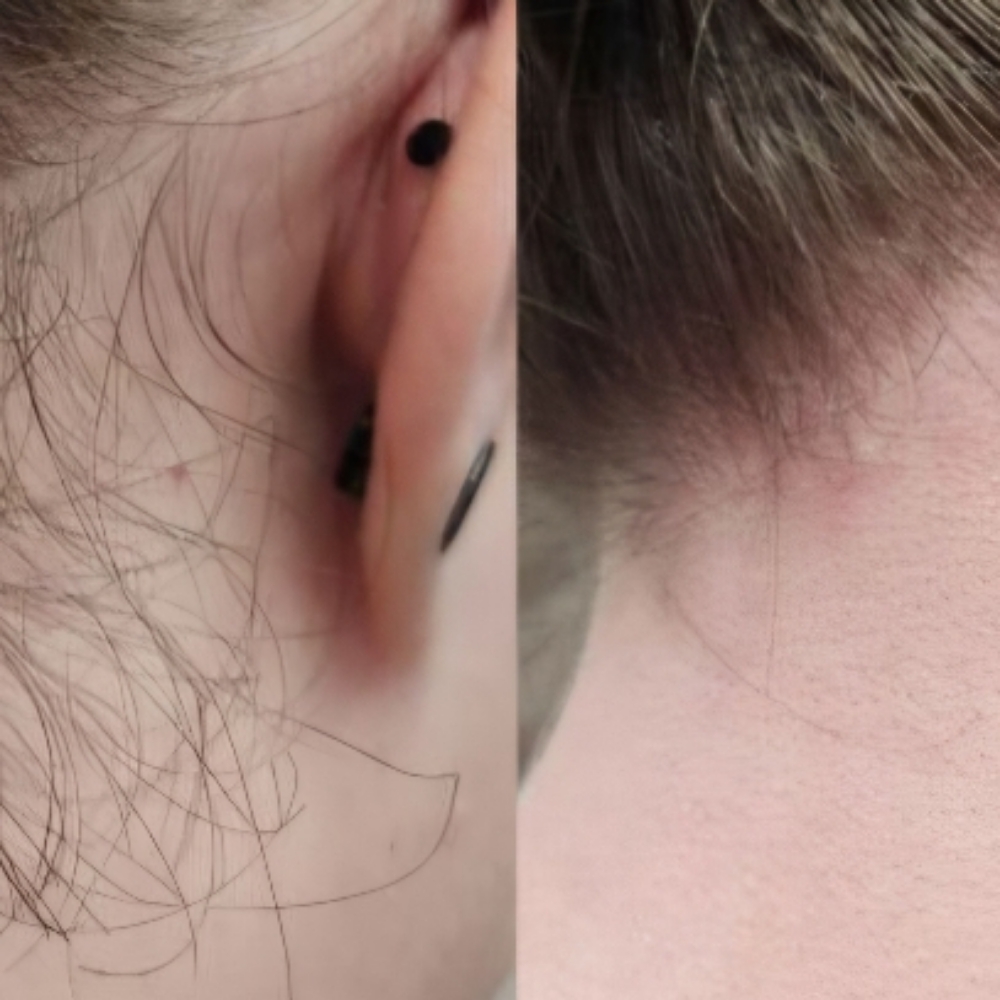 Neck Wax at Entouch Day Spa  |   La Pine's Premier Facial Spa & Waxing Studio in La Pine, OR