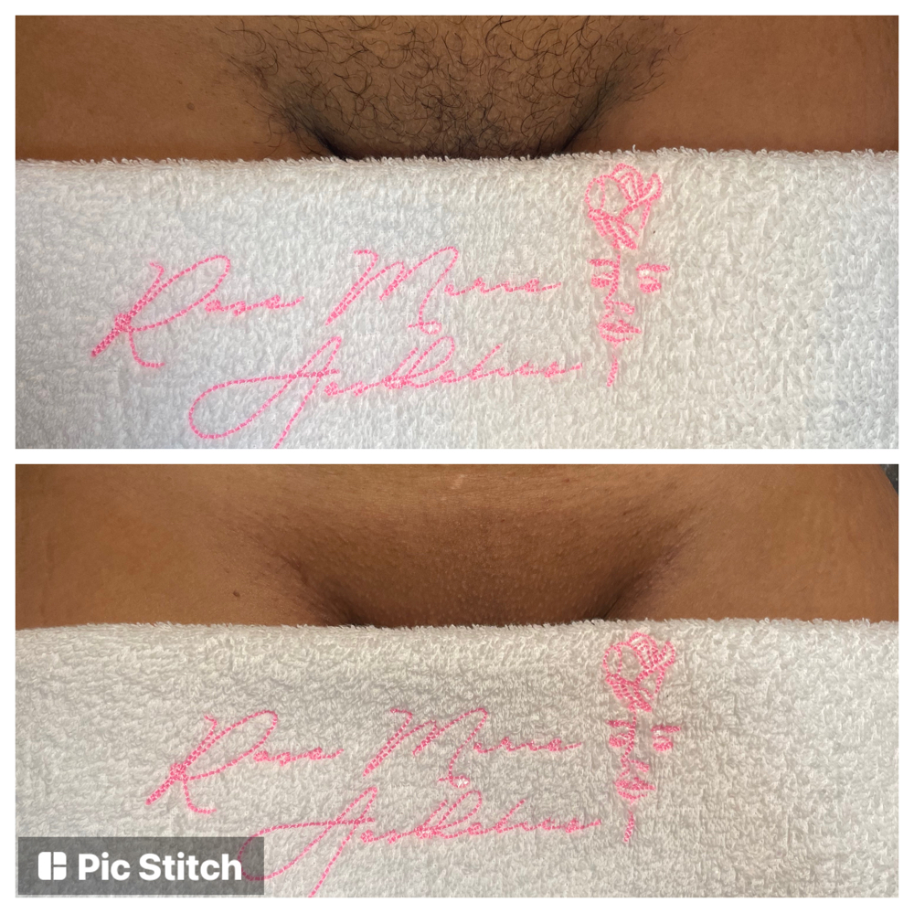 Full Brazilian Wax (Hard wax)