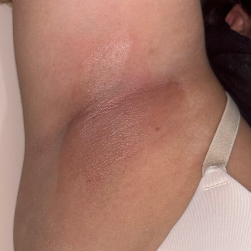 Arm Wax at Lush LLc in Greenville, RI