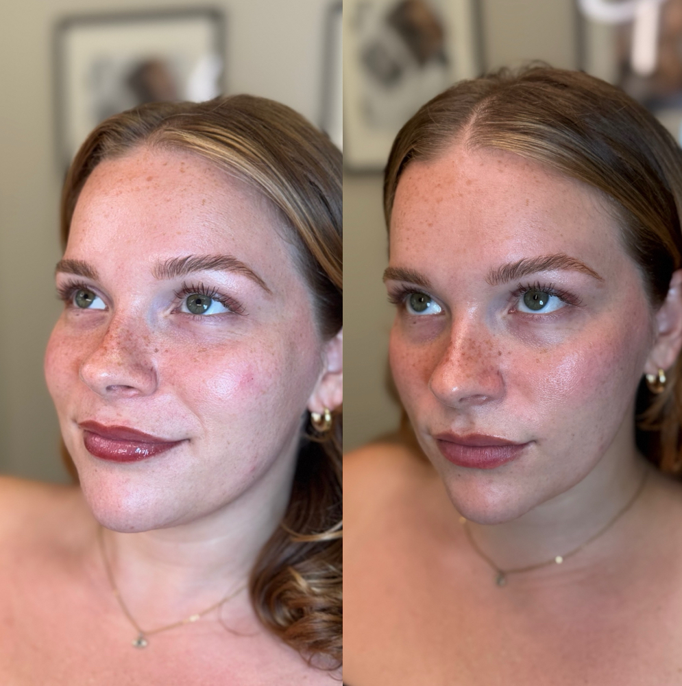 EZ GEL TREATMENT at Lace Skn in West Lake Hills, TX