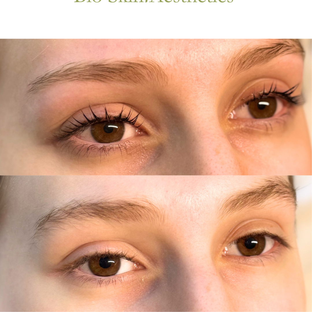 Lash Lift + Tint at Bio Skin Aesthetics in Boise, ID