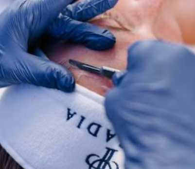Dermaplane