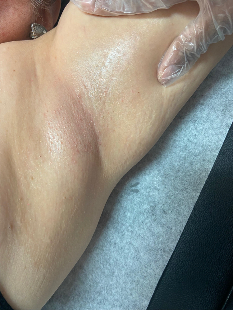 Under-Arm Wax