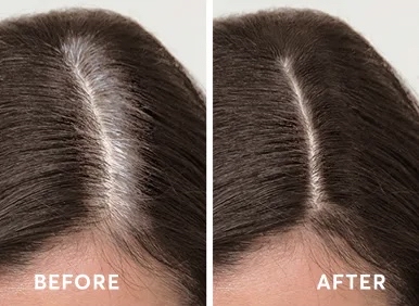 Retouch Roots