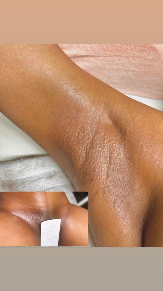 Brazilian w/ Underarm Wax