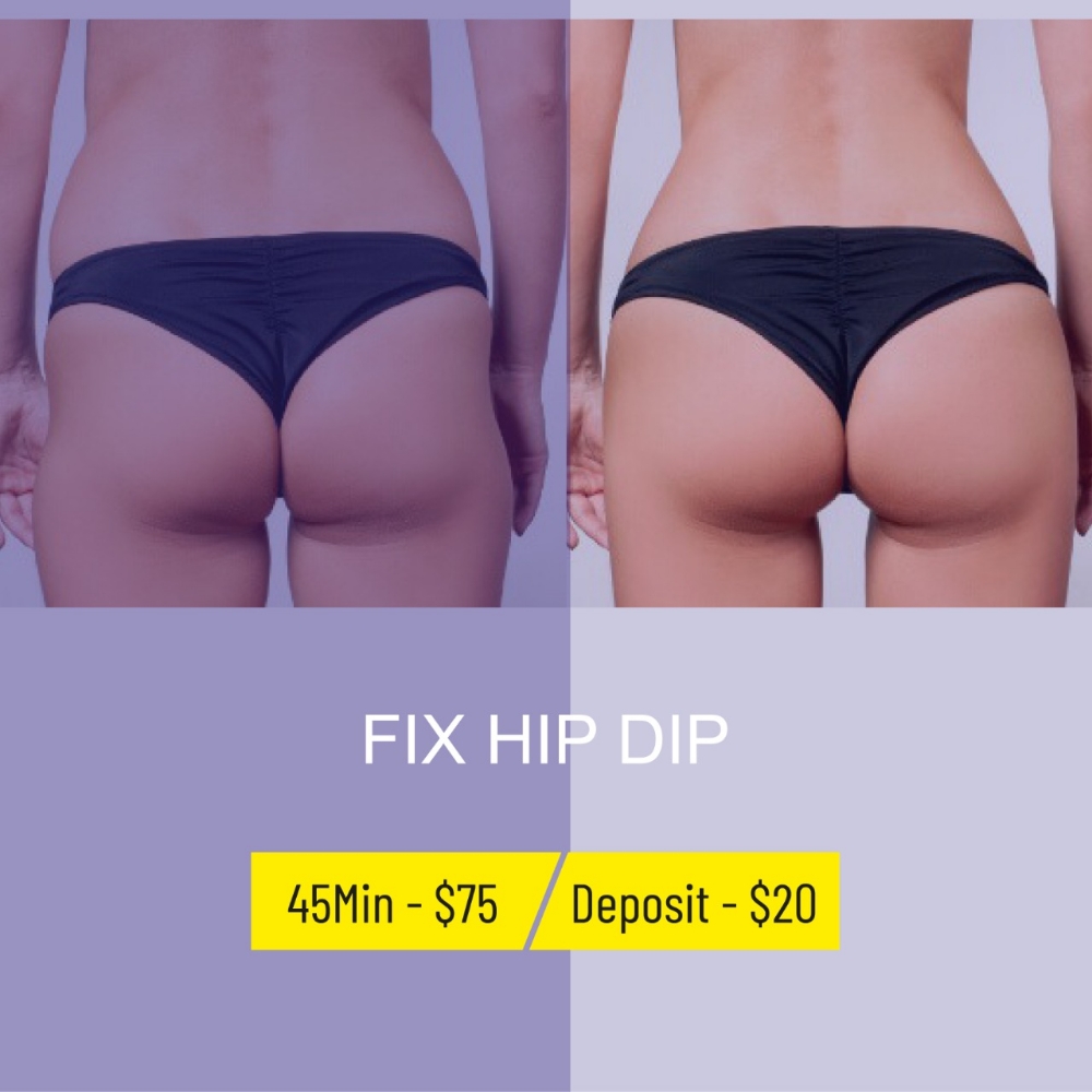 Fix Hip Dip