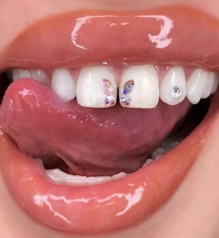 Butterfly Tooth Gem at Aura Beauty in shreveport, LA