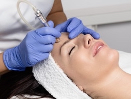 30 min Microdermabrasion