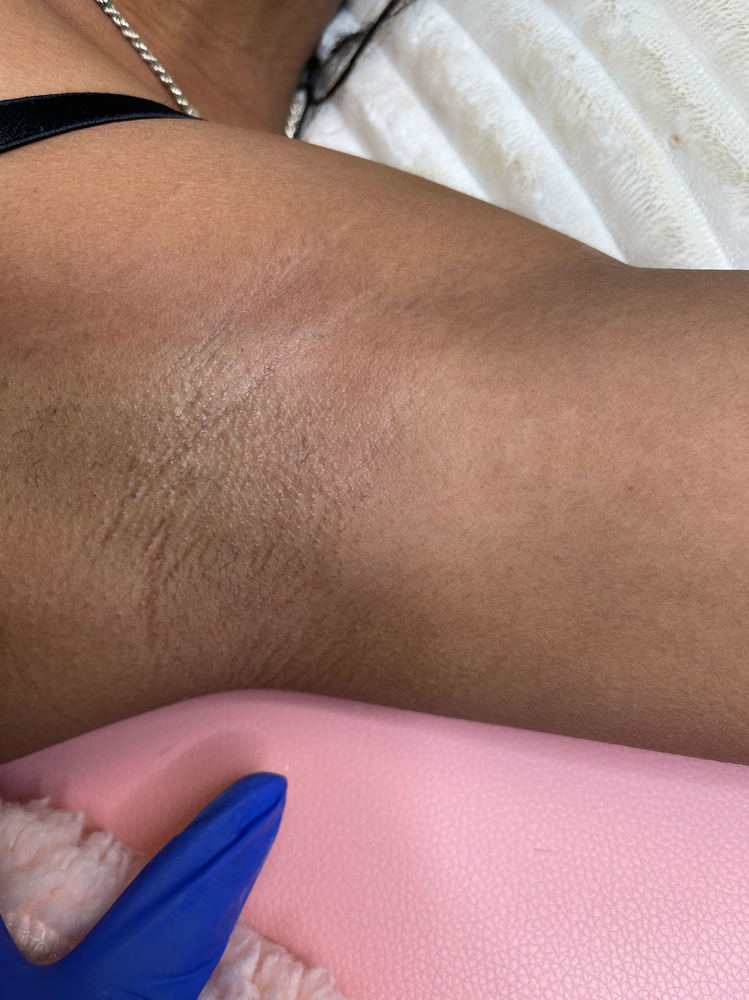 Underarm Wax