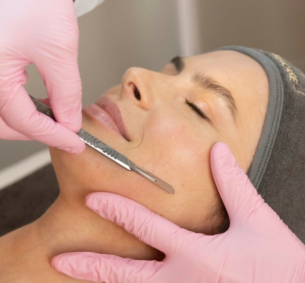 Dermaplane Add-On