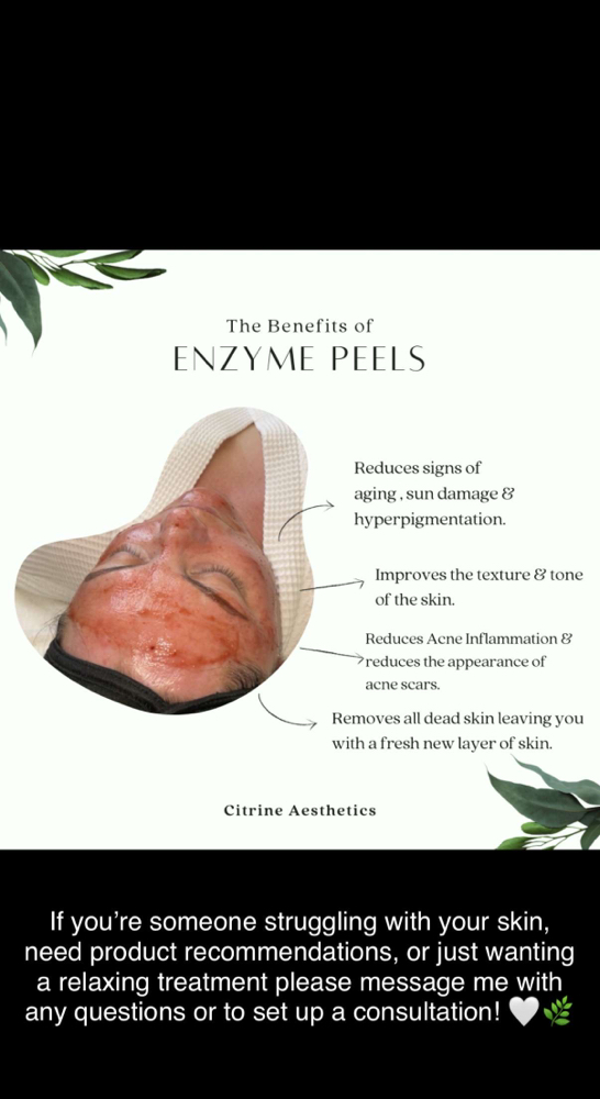 Enzyme Peel Mask - Add On