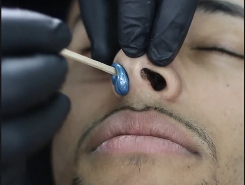NOSTRIL WAXING