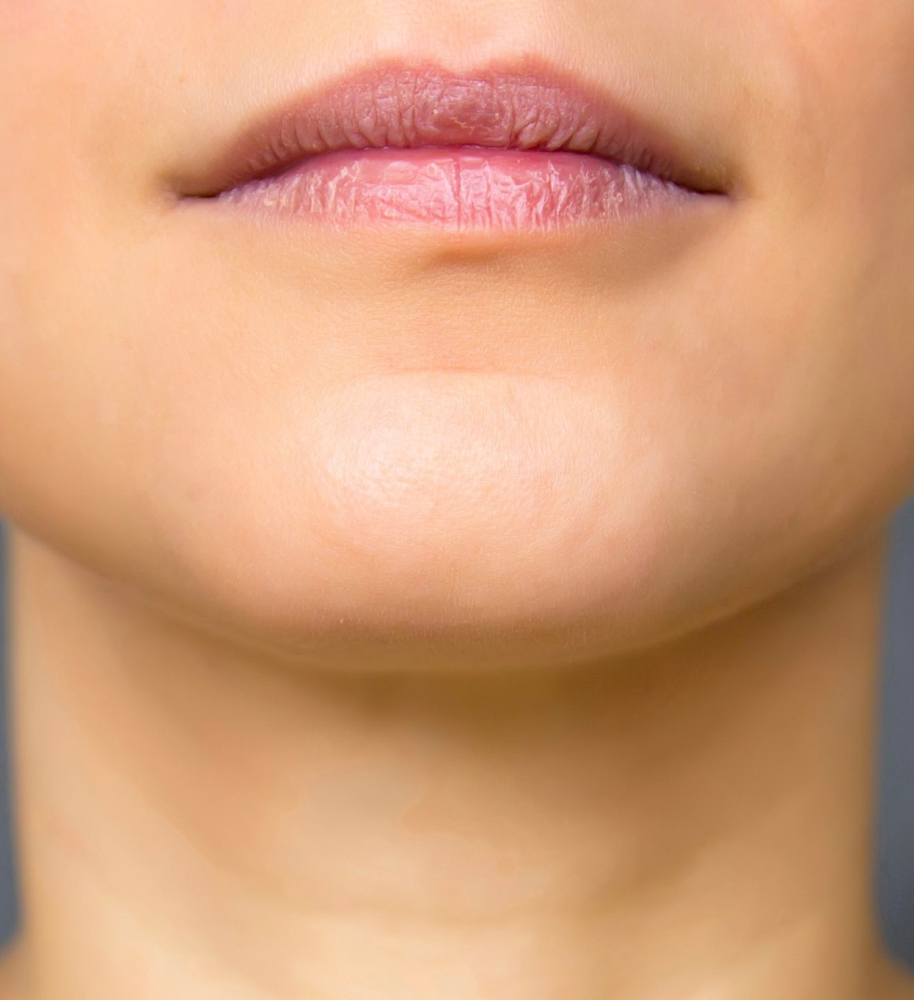 CHIN WAX