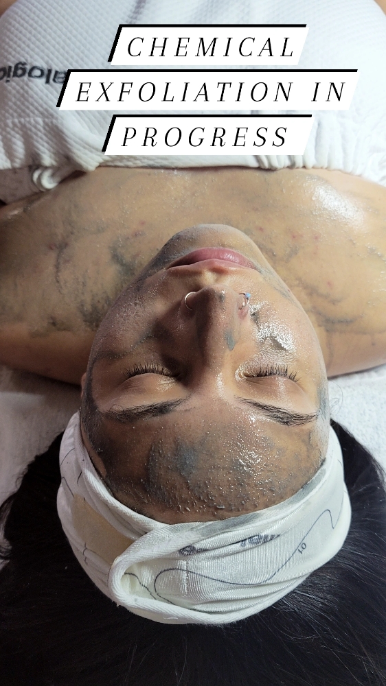 Teen Facial/Acne Facial