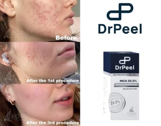 Dr Peel Package Of 3