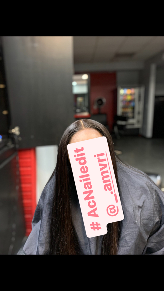 Frontal Pronto