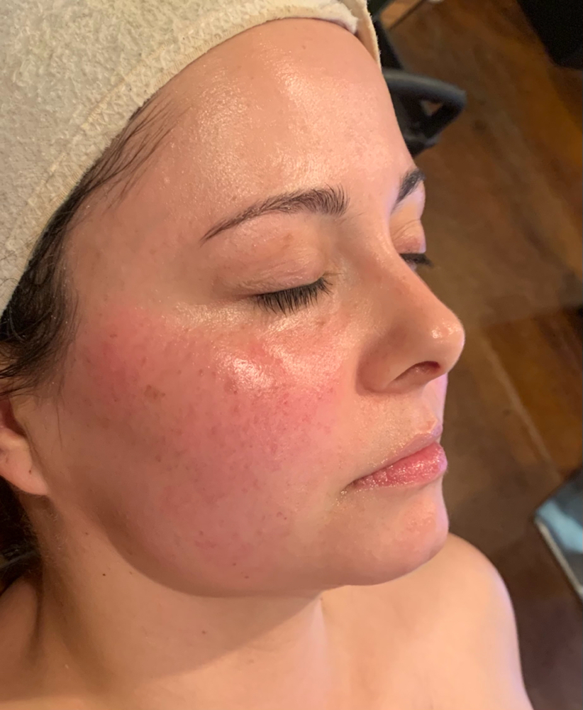 THE GLOW N GO FACIAL