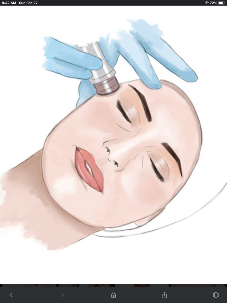 The Skin Deep Microderm Facial