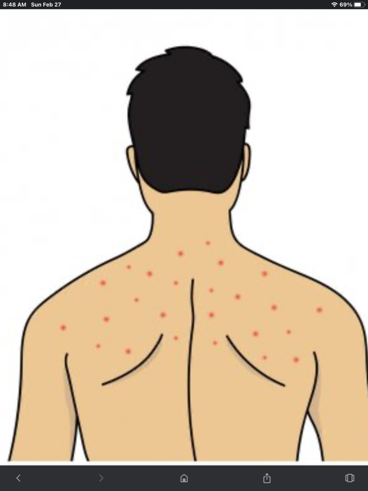 The Skin Deep Back Acne Facial