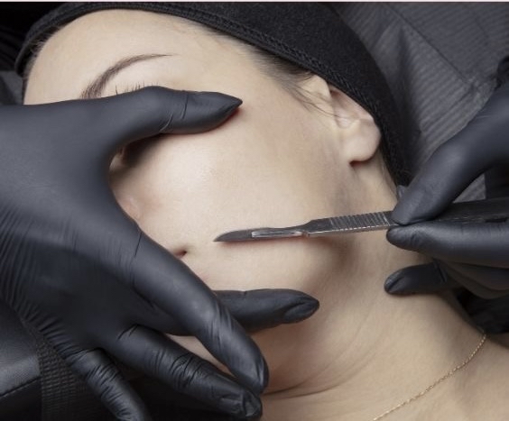 Dermaplaning