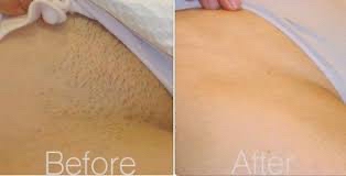 Bikini Line Wax