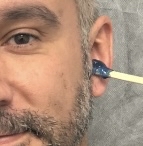 EAR WAXING