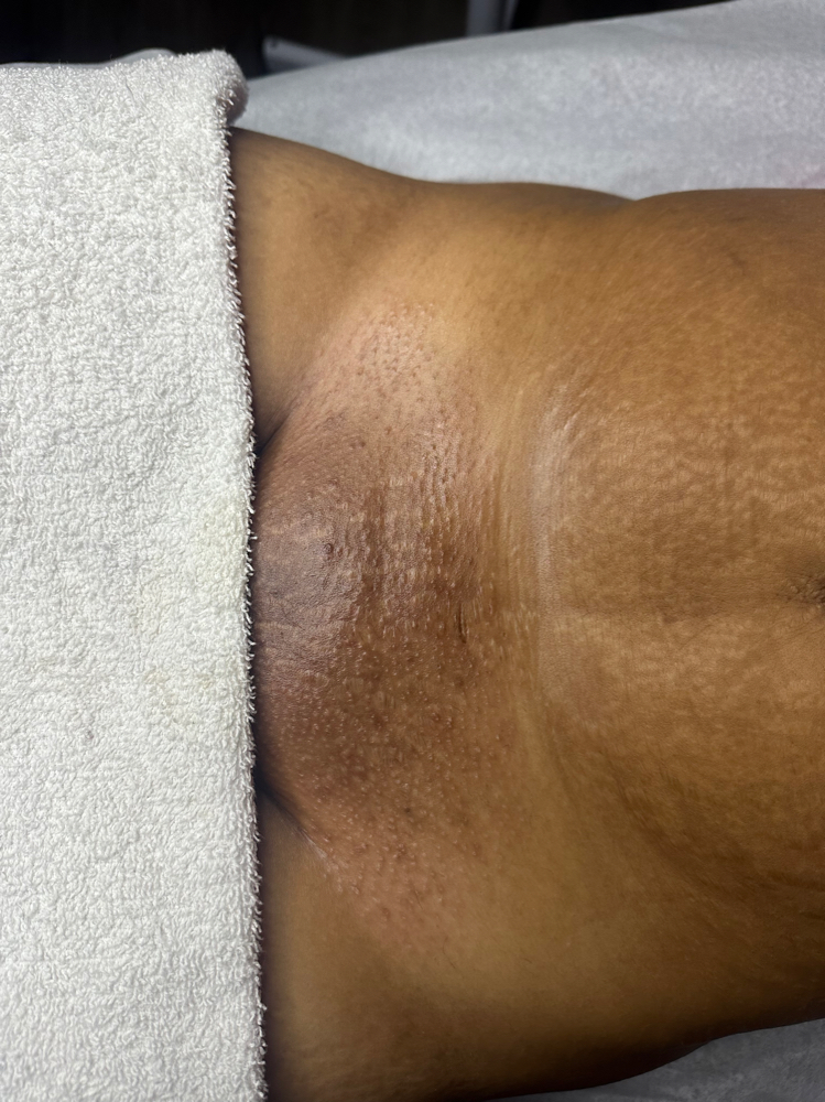 Brazilian Wax