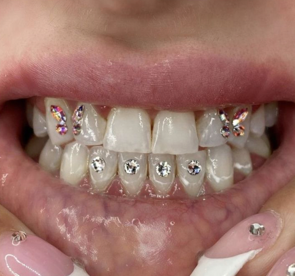 Tooth Gem