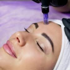 Microneedling Facial