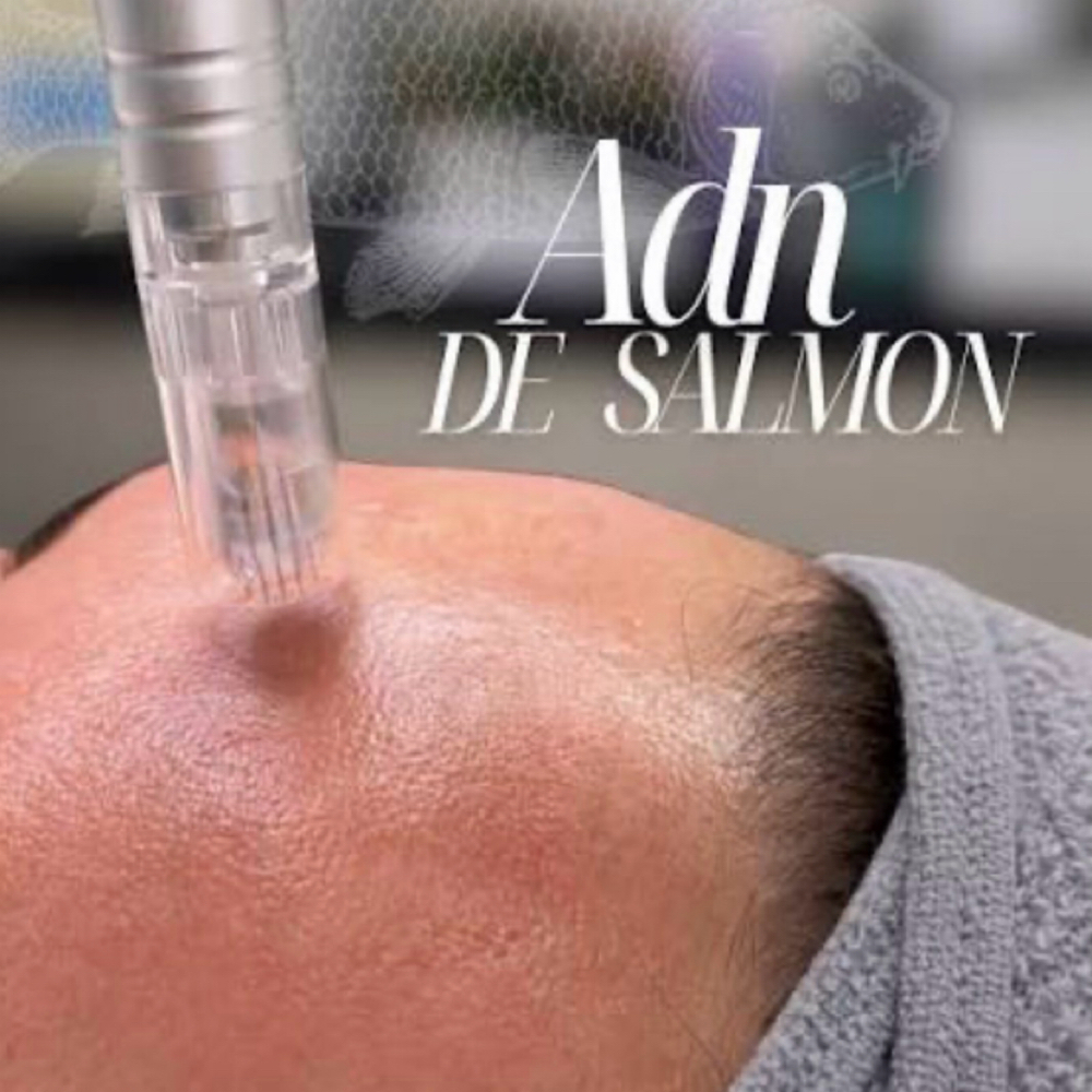 Salmon DNA facial/Microneedling at Colorado Beauty Bar in Aurora Colorado, CO